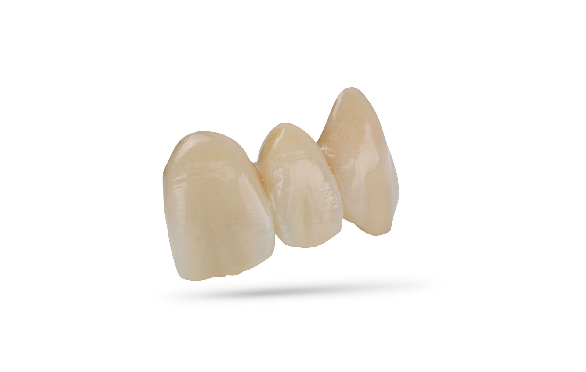 IPS Classic | Metal Ceramics | Ivoclar USA